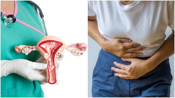 वजन बढ़ने से महिलाओं में गर्भाशय कैंसर का खतरा ज्‍यादा, बचने के लिए करें ये काम