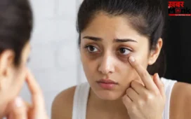 सिर्फ नींद की कमी नहीं ये 5 कारण भी बन सकते हैं डार्क सर्कल्स की वजह, आज ही हो जाएं सावधान!