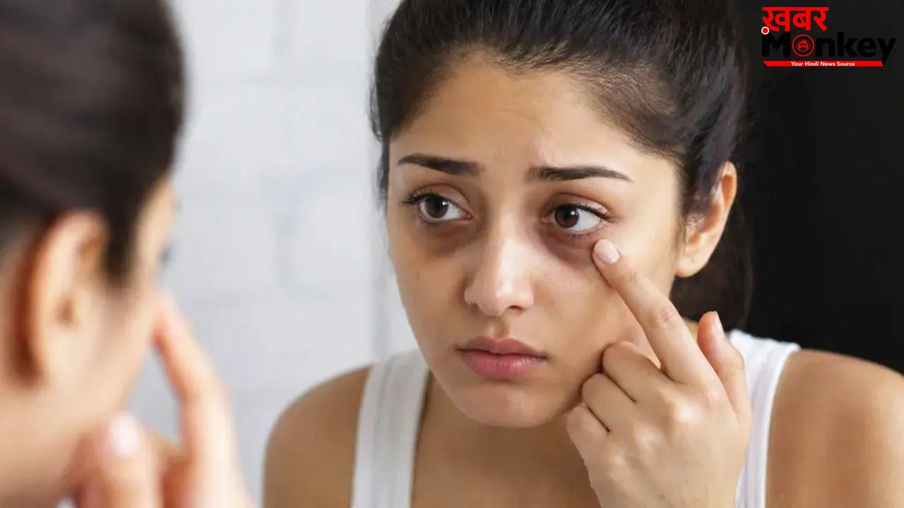 सिर्फ नींद की कमी नहीं ये 5 कारण भी बन सकते हैं डार्क सर्कल्स की वजह, आज ही हो जाएं सावधान!