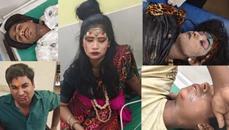 मुजफ्फरनगर में बालाजी शोभायात्रा में हादसा, ट्रैक्टर ने कलाकारों को रौंदा, आधा दर्जन घायल मुजफ्फरनगर में बालाजी शोभायात्रा में हादसा, ट्रैक्टर ने कलाकारों को रौंदा, आधा दर्जन घायल