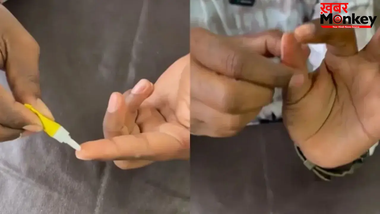 फेवीक्विक से चिपकी उंगलियां ऐसे छुड़ाने का दावा, वायरल वीडियो पर लोगों की नजर