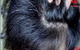 White Hair: बच्चों के बाल सफेद होने की वजह क्या है? जानिए इससे बचने के उपाय