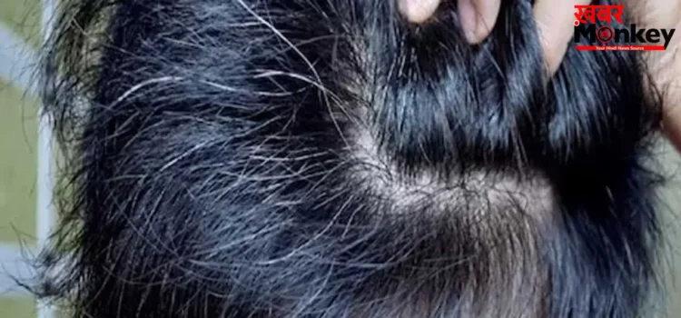 White Hair: बच्चों के बाल सफेद होने की वजह क्या है? जानिए इससे बचने के उपाय
