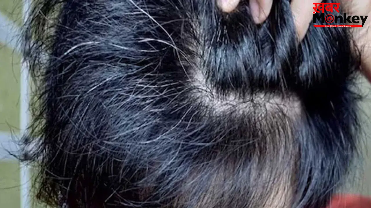 White Hair: बच्चों के बाल सफेद होने की वजह क्या है? जानिए इससे बचने के उपाय