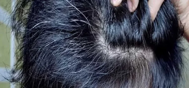 White Hair: बच्चों के बाल सफेद होने की वजह क्या है? जानिए इससे पचने के उपाय