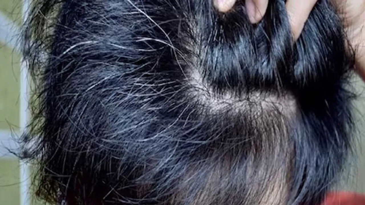 White Hair: बच्चों के बाल सफेद होने की वजह क्या है? जानिए इससे पचने के उपाय