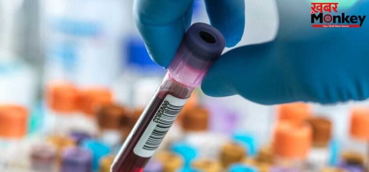 ब्लड टेस्ट में प्रोटीन का बढ़ना कितना खतरनाक? ये किस बीमारी का लक्षण है ब्लड टेस्ट में प्रोटीन का बढ़ना कितना खतरनाक? ये किस बीमारी का लक्षण है