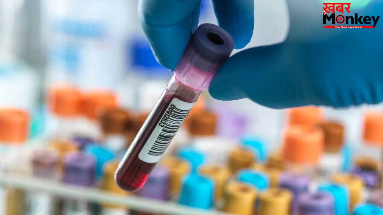 ब्लड टेस्ट में प्रोटीन का बढ़ना कितना खतरनाक? ये किस बीमारी का लक्षण है