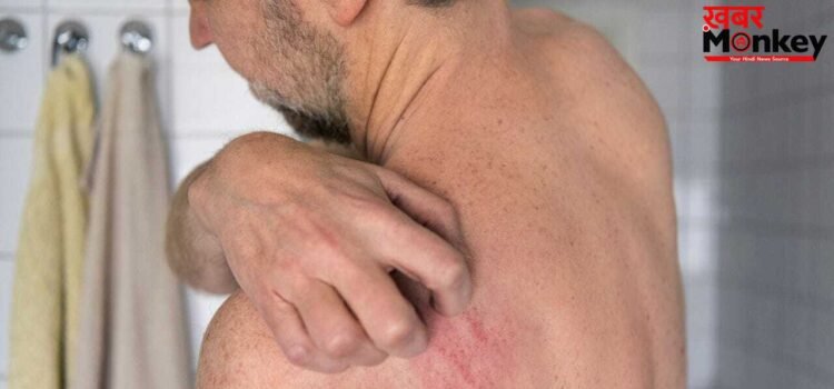 Remedies for Skin Itching: पीठ और पैरों पर होने वाली खुजली होगी दूर, आयुर्वेद एक्सपर्ट ने बताए आसान उपाय
