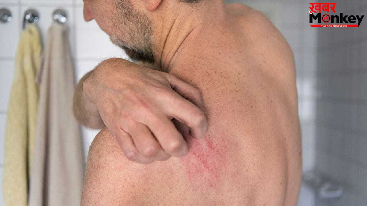 Remedies for Skin Itching: पीठ और पैरों पर होने वाली खुजली होगी दूर, आयुर्वेद एक्सपर्ट ने बताए आसान उपाय