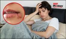 बुखार के बाद होंठों पर दाने क्यों निकल आते हैं, ये कितने दिन में ठीक होते हैं और सही करने के लिए क्या उपाय करें