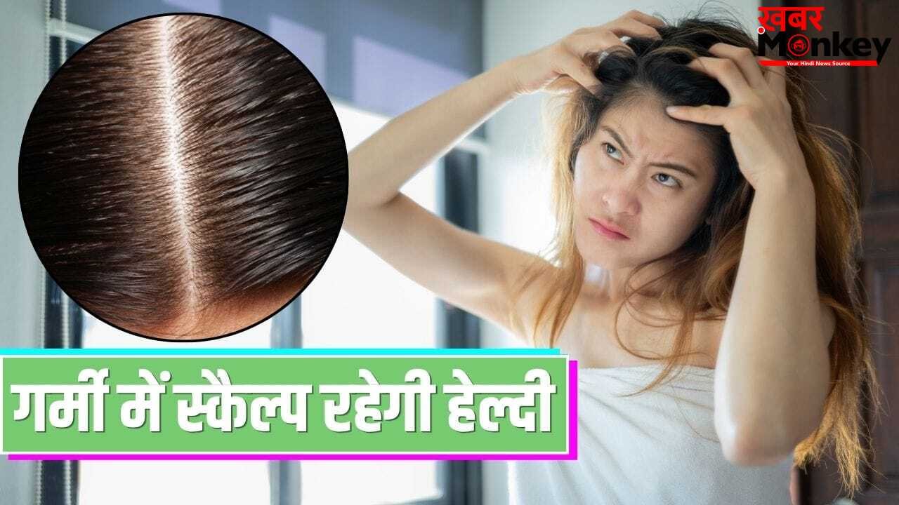 गर्मी में स्कैल्प की इचिंग और जलन नहीं करेगी परेशान, ये चीजें दिलाती हैं ठंडक
