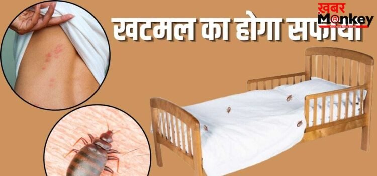 काट-काटकर किया हाल बेहाल…पलंग या सोफा में हो गए हैं खटमल, इन टिप्स से भगाएं दूर