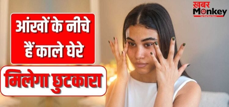 आंखों के नीचे हैं काले घेरे, सिर्फ क्रीम या देसी नुस्खे से नहीं चलेगा काम, ध्यान रखें ये बातें