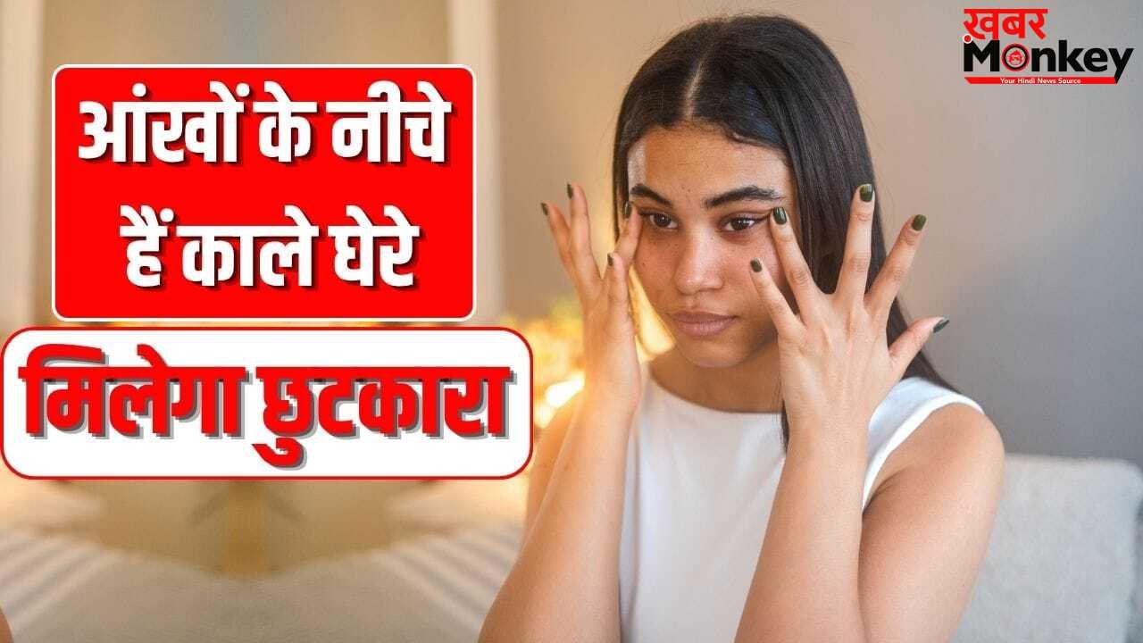 आंखों के नीचे हैं काले घेरे, सिर्फ क्रीम या देसी नुस्खे से नहीं चलेगा काम, ध्यान रखें ये बातें
