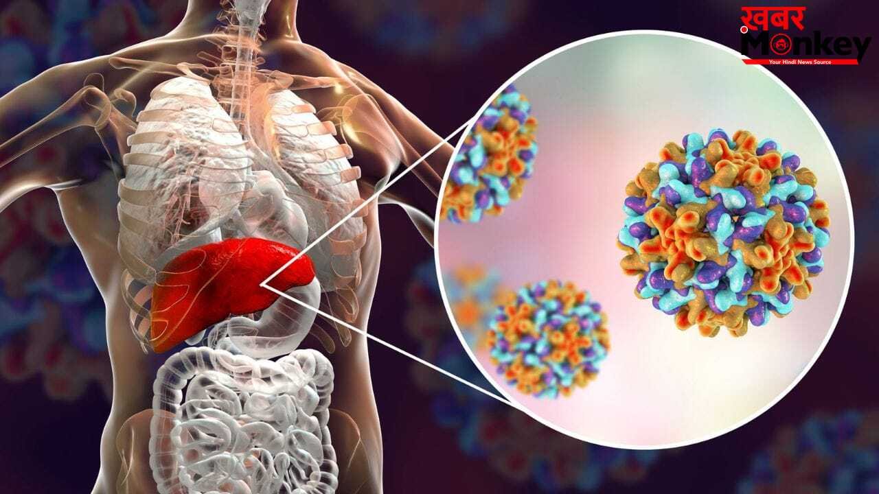 लिवर में बार-बार इंफेक्शन होना क्या कैंसर का संकेत है? एक्सपर्ट से जानें