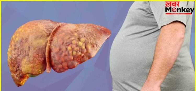ग्लोबल लेवल पर तेजी से बढ़ रही लीवर की समस्या, लैंसेट रिपोर्ट का दावा- 2050 में हो जाएंगे 2 अरब लोग पीड़ित