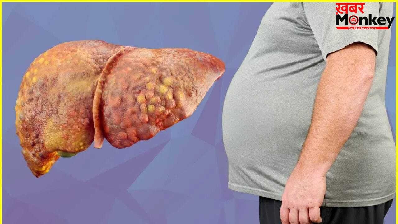 ग्लोबल लेवल पर तेजी से बढ़ रही लीवर की समस्या, लैंसेट रिपोर्ट का दावा- 2050 में हो जाएंगे 2 अरब लोग पीड़ित