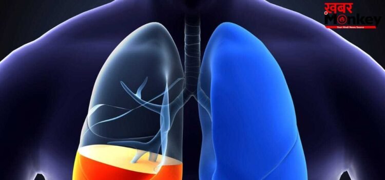 फेफड़ों में पानी भरना कितना खतरनाक, ये क्यों होता है, एक्सपर्ट्स से जानें