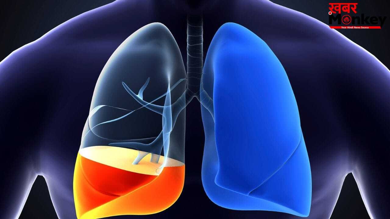 फेफड़ों में पानी भरना कितना खतरनाक, ये क्यों होता है, एक्सपर्ट्स से जानें