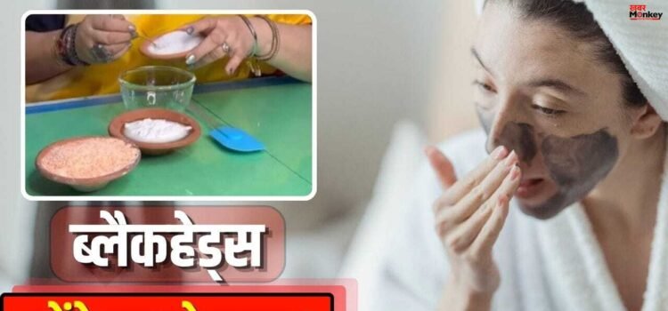 महंगे ट्रीटमेंट की नहीं जरूरत! ब्लैकहेड्स और वाइटहेड्स से मिलेगा छुटकारा, बस लगाएं ये 3 चीजें