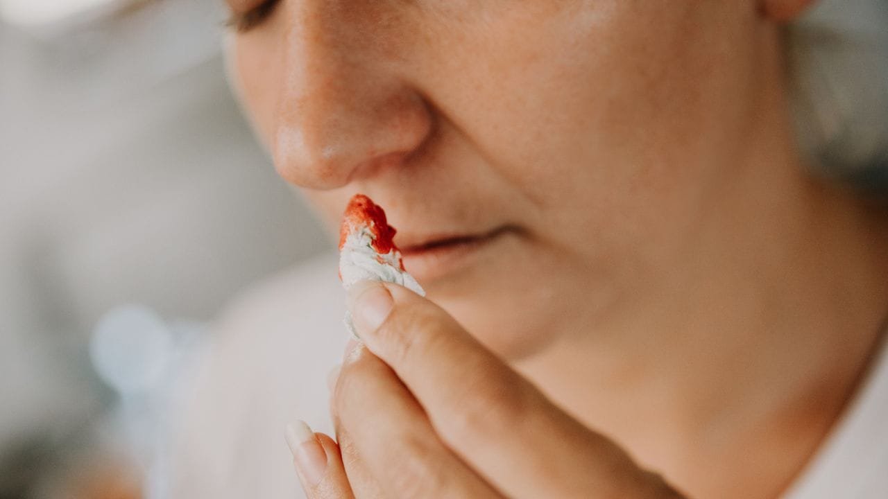 गर्मियों में नाक से खून आ गया है तो तुरंत क्या करें, ये क्यों होता है