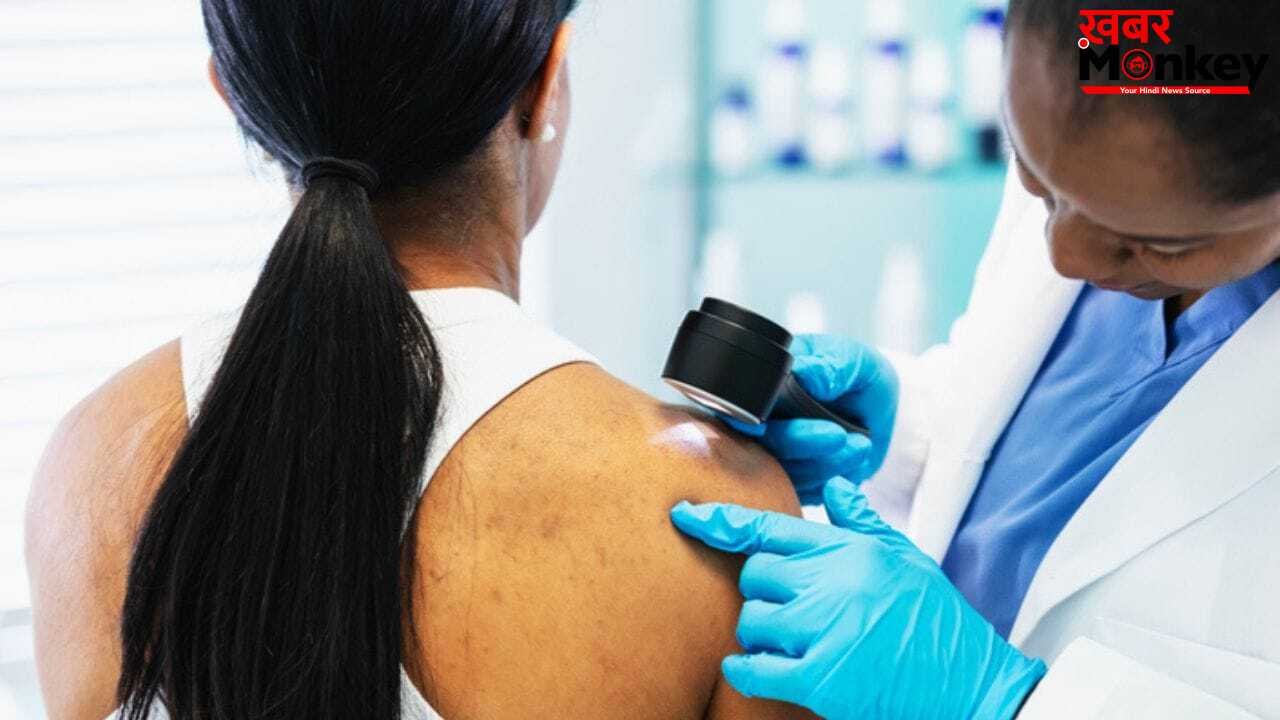 क्या गर्मियों में बढ़ जाता है स्किन कैंसर का खतरा? एक्सपर्ट से जानें