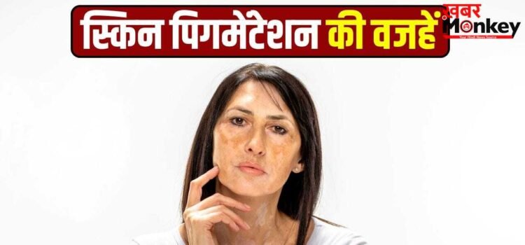 स्किन पिगमेंटेशन के क्या कारण हैं? इससे कैसे बचें