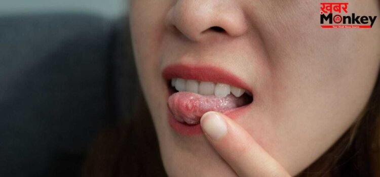 जीभ पर छाले क्यों होते हैं? क्या ये कोई खतरनाक बीमारी है जीभ पर छाले क्यों होते हैं? क्या ये कोई खतरनाक बीमारी है