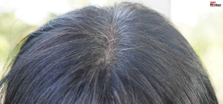 छोटे बच्चों के बाल सफेद क्यों होते हैं? विटामिन की कमी या बीमारी का संकेत छोटे बच्चों के बाल सफेद क्यों होते हैं? विटामिन की कमी या बीमारी का संकेत