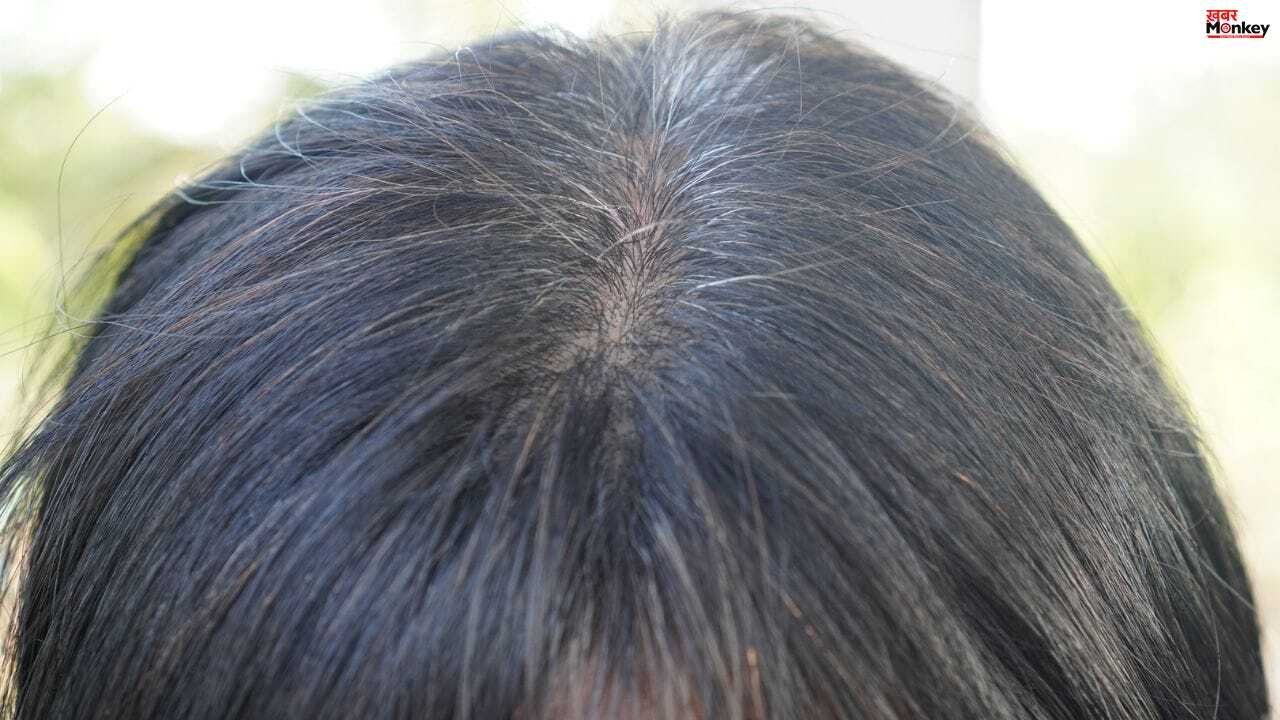 छोटे बच्चों के बाल सफेद क्यों होते हैं? विटामिन की कमी या बीमारी का संकेत