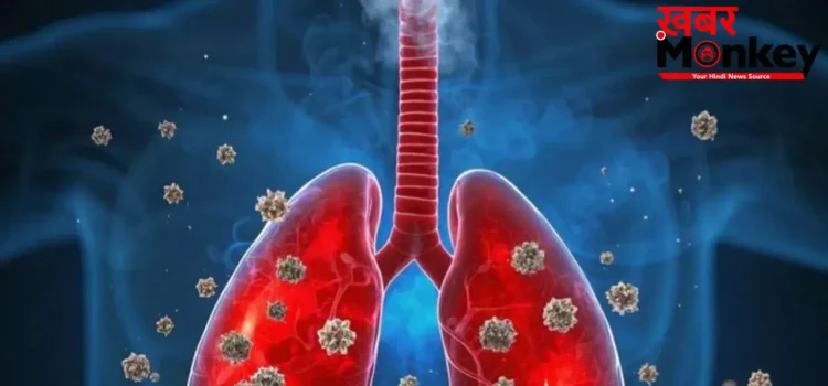 Lung Infection: जिद्दी खांसी जो जाने का नाम नहीं ले रही,  कहीं ये 4 गंभीर बीमारियां दस्तक तो नहीं दे रहीं?