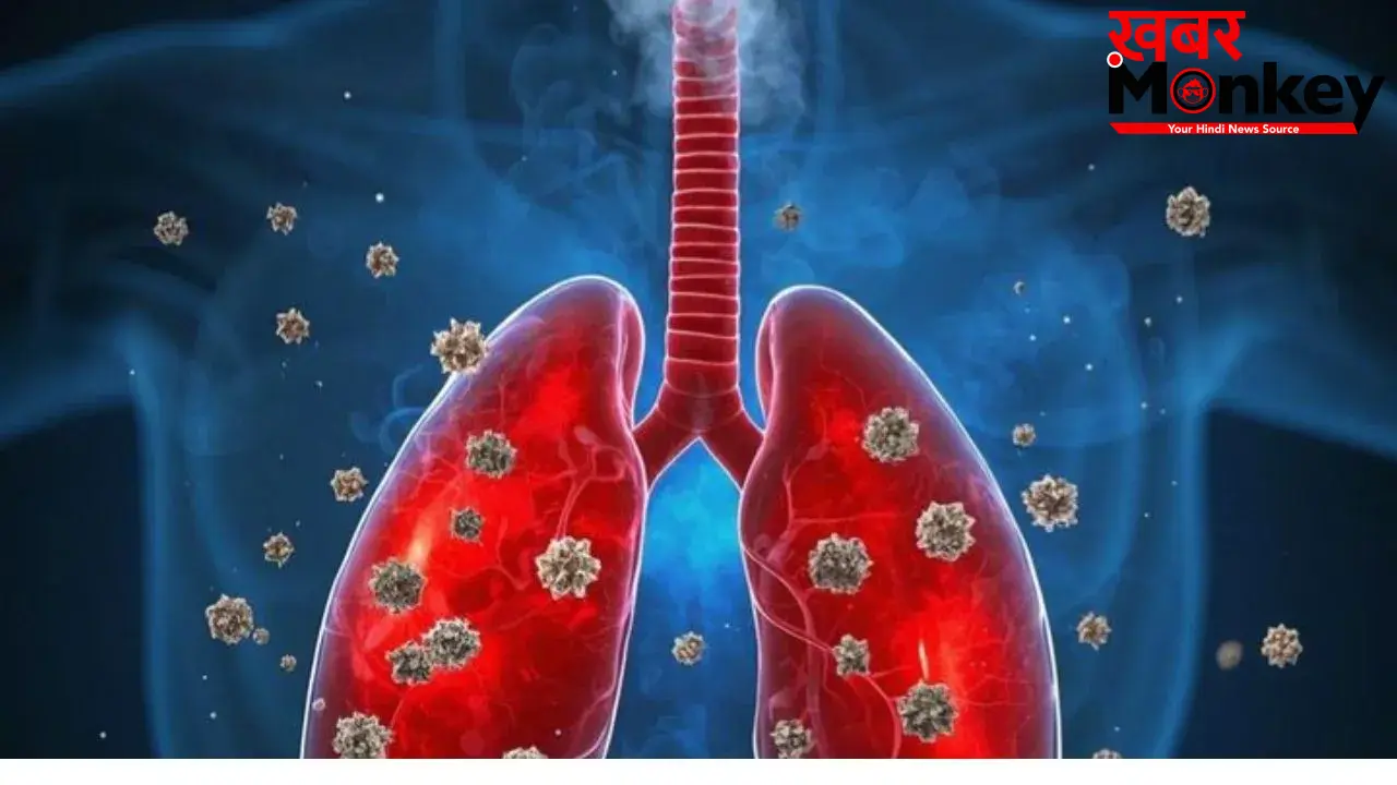 Lung Infection: जिद्दी खांसी जो जाने का नाम नहीं ले रही, कहीं ये 4 गंभीर बीमारियां दस्तक तो नहीं दे रहीं?