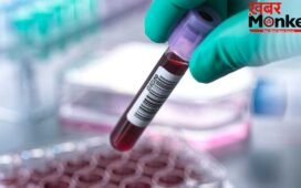 98% ब्लड सैंपल्स में मिले फॉरएवर केमिकल्स, जानें सेहत पर कैसे पड़ता है असर