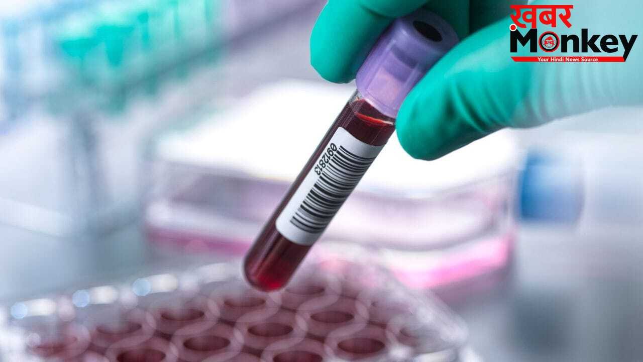 98% ब्लड सैंपल्स में मिले फॉरएवर केमिकल्स, जानें सेहत पर कैसे पड़ता है असर