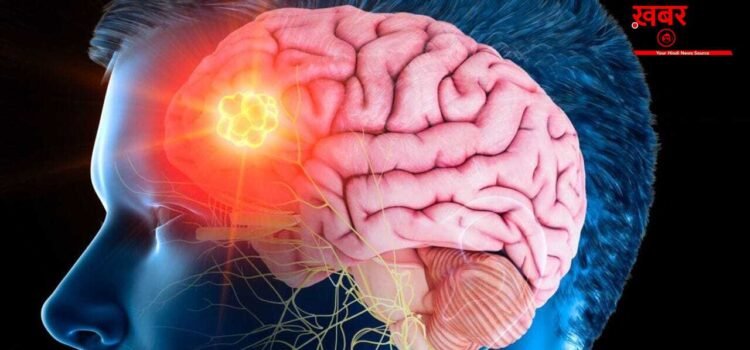 Brain stroke recovery : ब्रेन स्ट्रोक के बाद रिकवरी भी है जरूरी, डॉक्टर से जानें टिप्स