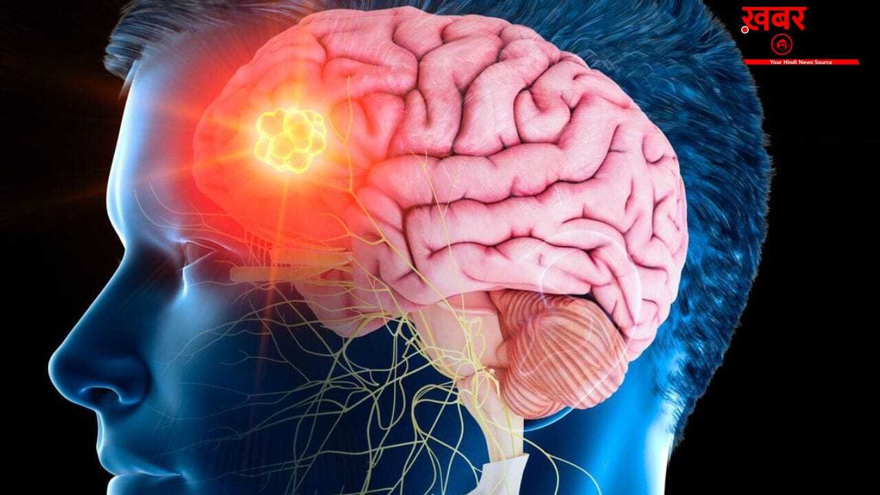 Brain stroke recovery : ब्रेन स्ट्रोक के बाद रिकवरी भी है जरूरी, डॉक्टर से जानें टिप्स