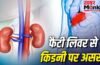 क्या फैटी लिवर से बिगड़ जाती है किडनी की हेल्थ, जानें दोनों में कनेक्शन