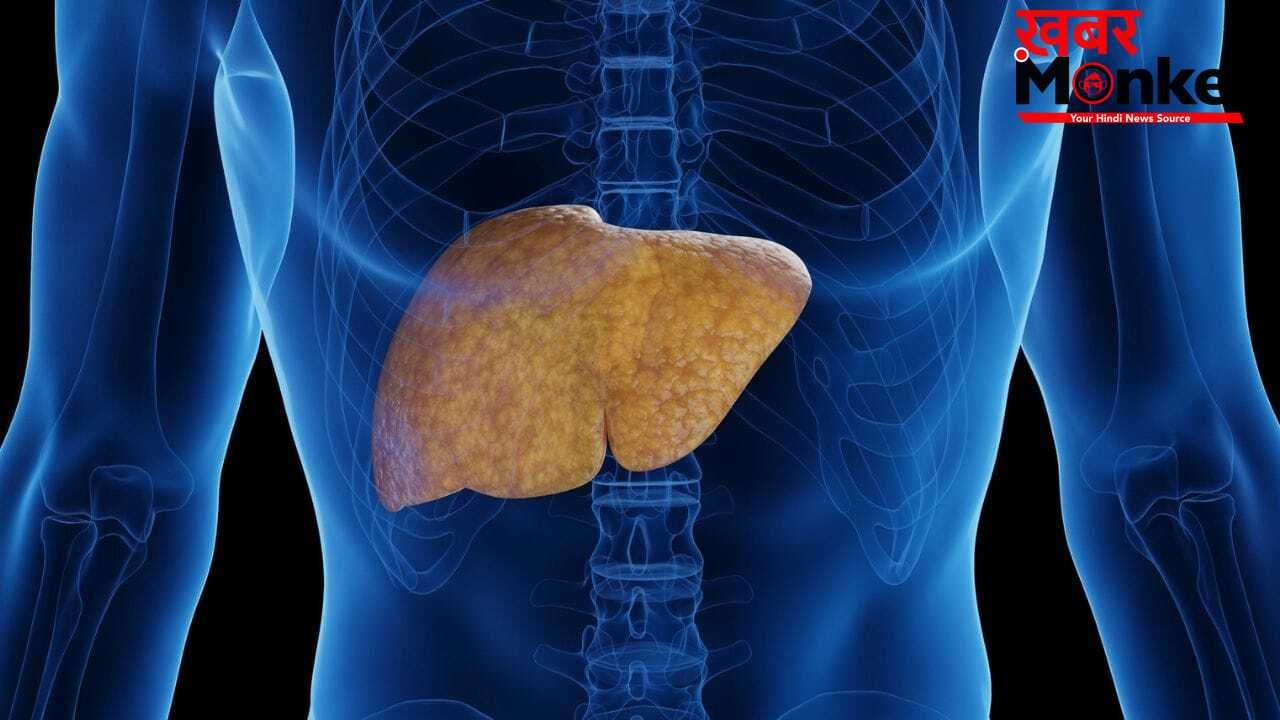 फैटी लिवर का असर शरीर के किन अंगों पर पड़ सकता है? एक्सपर्ट से जानें