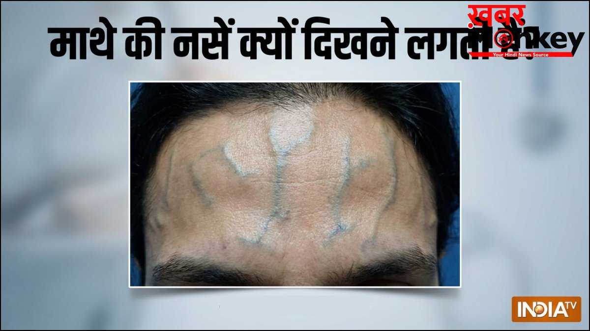 माथे की नसें क्यों दिखने लगती हैं, नस फड़कने पर क्या करें, जानिए इसके कारण और ठीक करने के उपाय