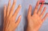 Hast Rekha: छठी उंगली सिर्फ Lucky Charm नहीं, Palmistry से जानें ऐसे लोगों की Secret Personality Hast Rekha: छठी उंगली सिर्फ Lucky Charm नहीं, Palmistry से जानें ऐसे लोगों की Secret Personality