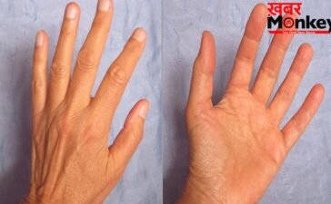 Hast Rekha: छठी उंगली सिर्फ Lucky Charm नहीं, Palmistry से जानें ऐसे लोगों की Secret Personality