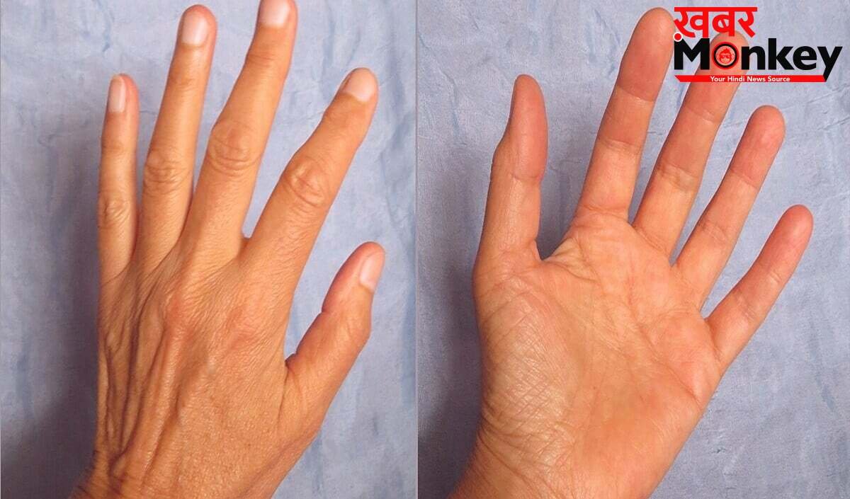 Hast Rekha: छठी उंगली सिर्फ Lucky Charm नहीं, Palmistry से जानें ऐसे लोगों की Secret Personality