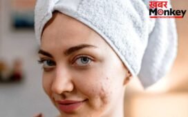 Pimples-Acne Problem: चेहरे पर एक्ने-पिंपल्स का खतरा बढ़ाती हैं ये खाने की चीजें, आज ही बनाएं दूरी