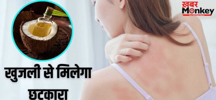 Summer Skin Care Remedy: गर्मी से हो रही खुजली-महीन दानों का होगा सफाया, नारियल तेल में मिलाकर लगा लें ये 1 चीज