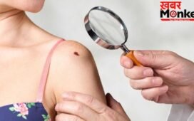 शरीर पर मौजूद तिल सुरक्षित है या सेहत के लिए खतरनाक? ऐसे करें पहचान