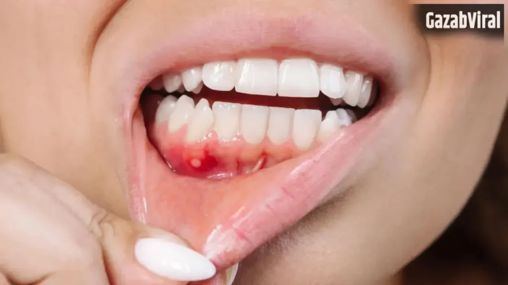Gum Problems: क्या आपके मसूड़ों से भी आता है खून? भूलकर भी न करें नजरअंदाज, एक्सपर्ट ने बताए इसके बड़े कारण​