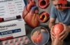 कोलेस्ट्रॉल कम करने वाली Statin दवा से क्यों होता है मांसपेशियों में दर्द? रिसर्च से जानिए कारण