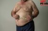 Obesity in Men: पुरुषों में पेट निकलना सिर्फ मोटापा नहीं, हो सकता है यह कारण