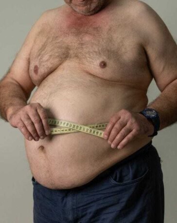 Obesity in Men: पुरुषों में पेट निकलना सिर्फ मोटापा नहीं, हो सकता है यह कारण